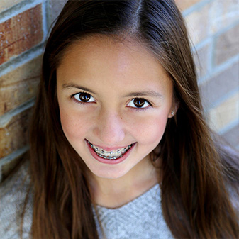 Early orthodontic treatment for children in Aspen Orthodontics